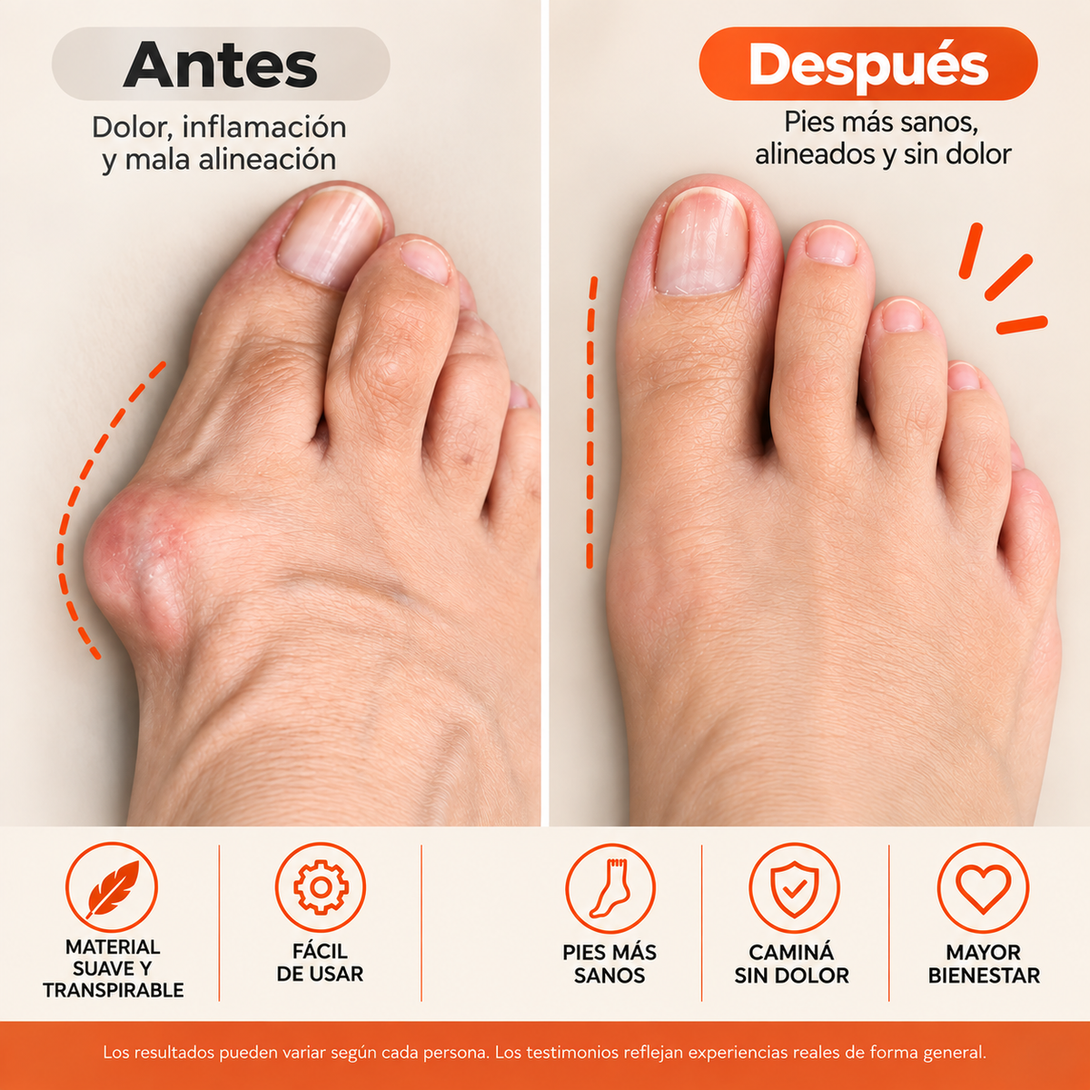 KIT ANTI-JUANETES ORTOPEDICO NOREX