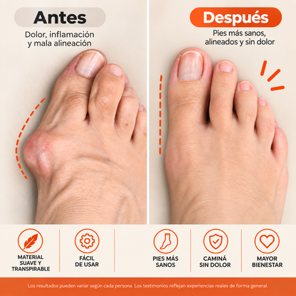 KIT ANTI-JUANETES ORTOPEDICO NOREX