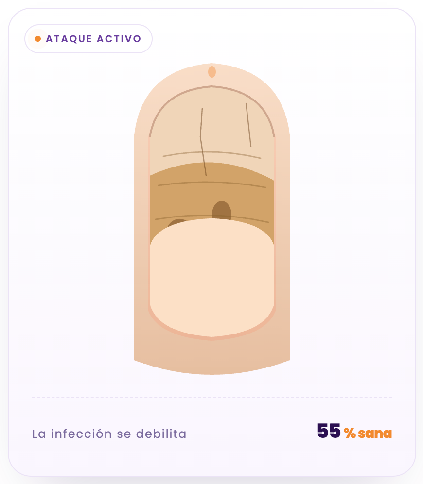 Rompe el escudo del hongo desde adentro.
