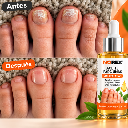 NOREVEX: El aceite que elimina el 99.9% de los hongos en tus uñas.