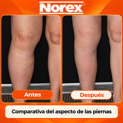 Medias de compresión 3:4 (Con cierres) NOREX