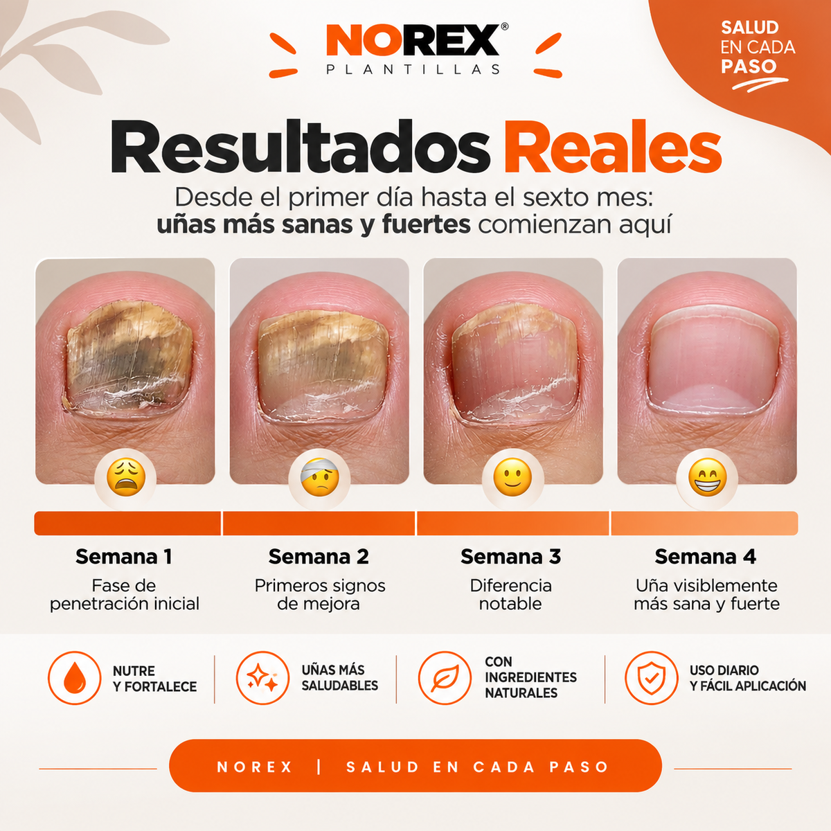 NOREVEX: El aceite que elimina el 99.9% de los hongos en tus uñas.