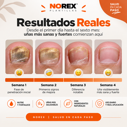 NOREVEX: El aceite que elimina el 99.9% de los hongos en tus uñas.